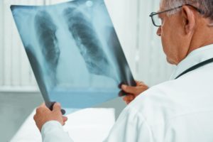 doctor looking at x ray image of chest