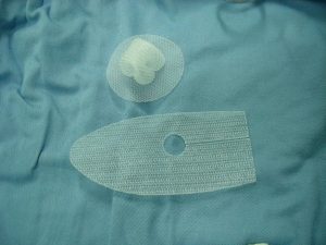 synthetic surgical hernia mesh