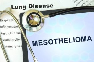 Mesothelioma Attorney