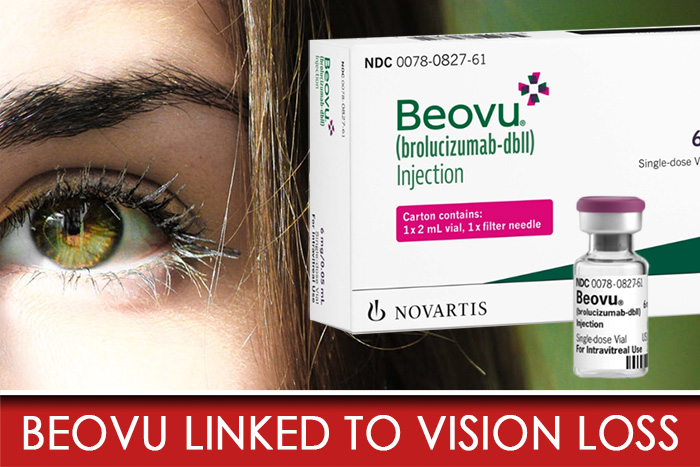 Beovu Linked to Vision Loss