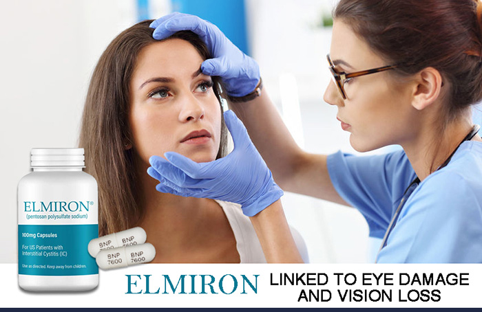 Elmiron linked to eye damage and vision loss